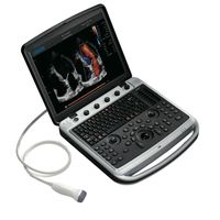 УЗИ аппарат Chison SonoBook 9