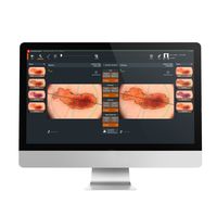 Дерматоскоп FotoFinder Moleanalyser Pro