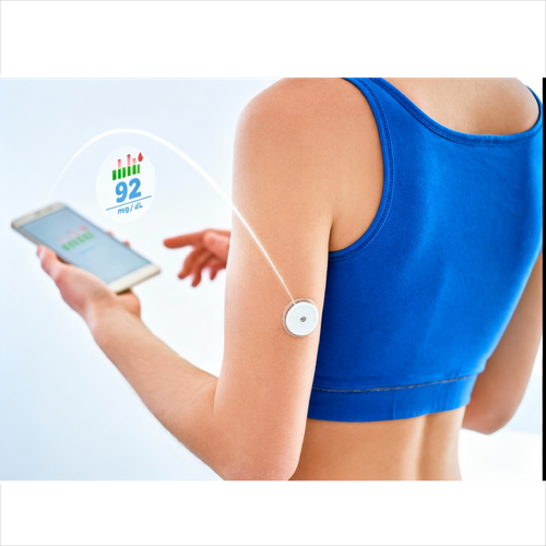 Собственная система непрерывного мониторинга глюкозы